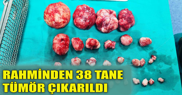 Rahminden 38 tane tümör çıkarıldı