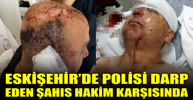 Eskişehir'de polisi darp eden şahıs hakim karşısında