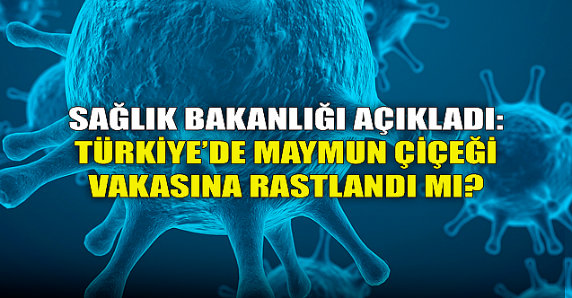 Sağlık Bakanlığı açıkladı: Türkiye'de Maymun Çiçeği vakası görüldü mü?